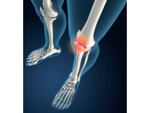 ��ʪ���ؽ��׿��� �������Է���Ҫ����