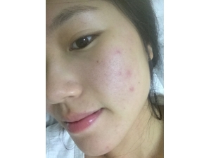 ����ʪ���صı��� ͷ�跢����̦����