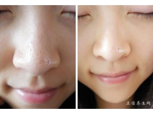 ȥ����ͷ�ķ�������Щ��