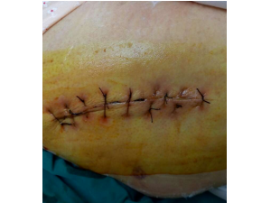 ��ҧ�˵����� ����Ҫ���ý���������