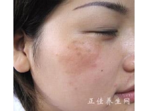  ���ϳ��ƺְ���ҽ��ô������