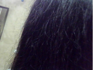 ͷ���ɿ���ô�� ��ҽ����������