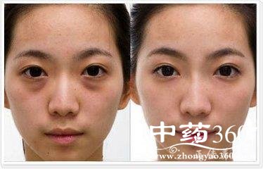 t015655311d26e1f879.jpg t015655311d26e1f879.jpg