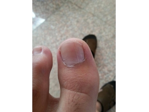 ��ֺ�׷�����ô��?�����������Ч