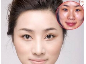 ¡��������� �������η���