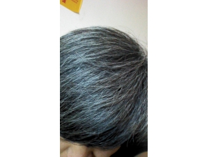 ����׷���ô�� ��ѡ�����취��Ӧ��