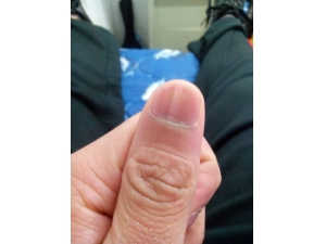 ָ���������Ƶ�ԭ�� ����ָ�������߳Ե�ʳ��