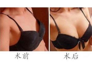 ��֬¡����Ҫע���Ĵ�����