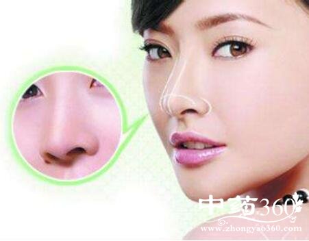 隆鼻子手术注意事项?