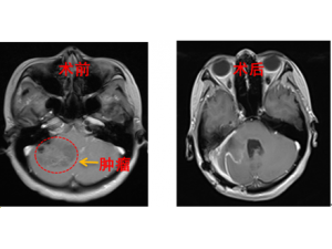 �и�­�ڳ��޴����� ��ҽ�����ʹ�������������