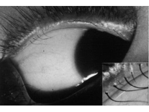 �山һ�걦�������۾� ԭ���ǵ���ë����