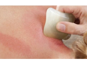 ���������ʪ������ ��ҽ���������ʪ