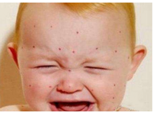 ��ͯƤ��������ԭ�� ��ͯƤ��������Щʳ�ﲻ�ܳ�