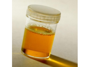 ��ʧ��������� �Ƽ�����ƫ������ʧ��