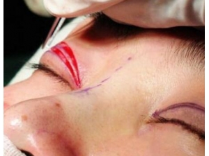 ��˫��Ƥ��Σ�� ��Ƥ�����ָ���