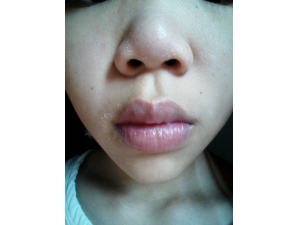 ϵͳԺǴҪ ΪʲôỼ