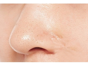 С�մ�ˮȥ��ͷЧ����ô�� С�մ�ˮҲ��ȥ��ͷ��