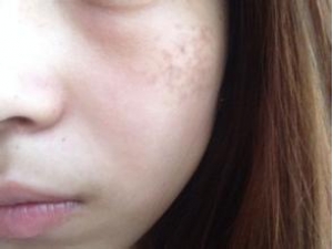 ��ôȥ���ƺְ� ȥ���ƺְߵ�ʳ�Ʒ�