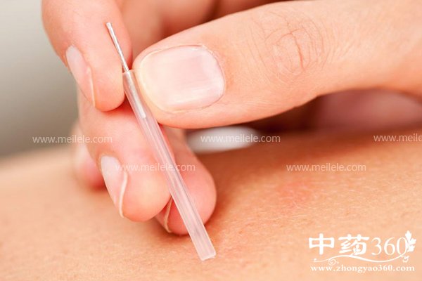 zhenjiujianfeiyouxiaoma 