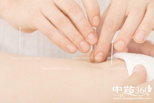 zhenjiujianfeiyouxiaoma 