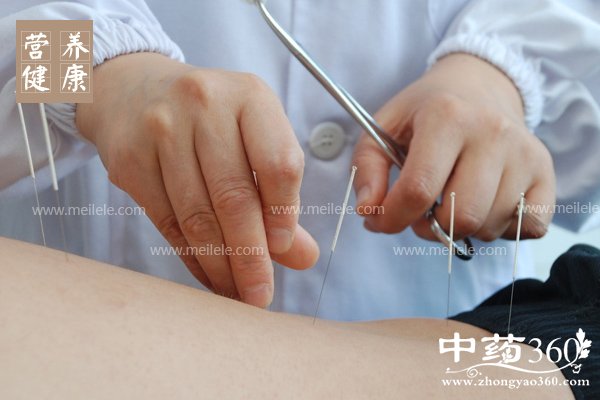 zhenjiujianfeiyouxiaoma 