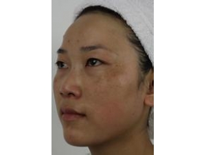 ���ƺְ���ô�� ��������ƺְߵķ���