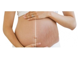 �������������� ��ʲô������������