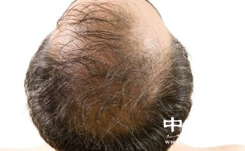 ͺԭЩ ôֹѷ ҪֹѷҪʲô