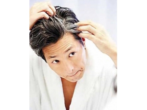 ����ٰ�ͷ������?��Щʳ�Ʒ������ư׷�