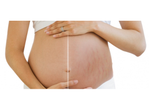 ����޸������� �������������Ƶķ���