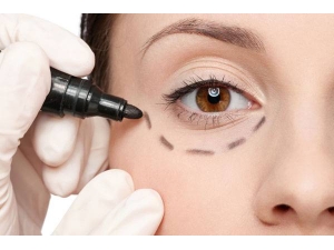 �۴����γ�ԭ����ȥ������