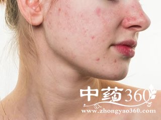 1501147060415406.jpg 1501147060415406.jpg