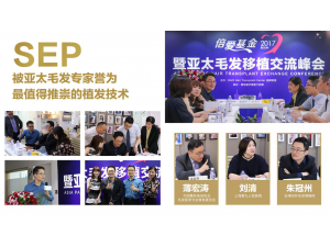 ���ݱ���ֲ��SEP��������ֲ������---ֲ���۸�ֲ��Ч��