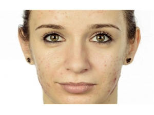 10��С�����������������ӡ