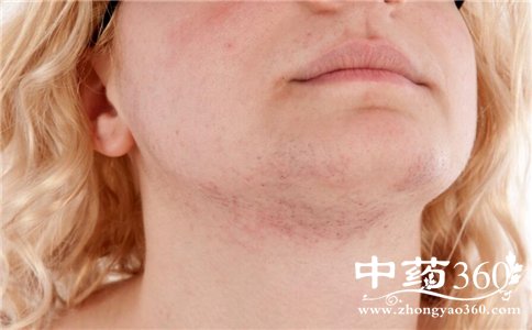 皮肤缺水的表现你中招了吗 皮肤缺水的表现是什么 皮肤缺水怎么办 如何给皮肤补水