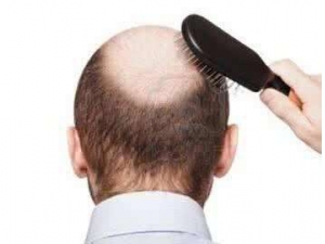 ��������ѷ���3��ԭ��һ��Ҫע�⣡