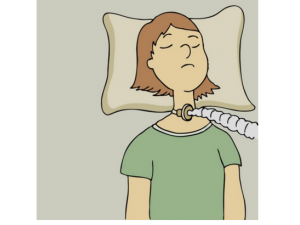 ��ʽ���������ڷβ����� ��֪����