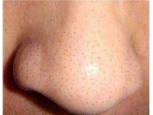 ��������ݮ�� ���������ߵķ�������Щ