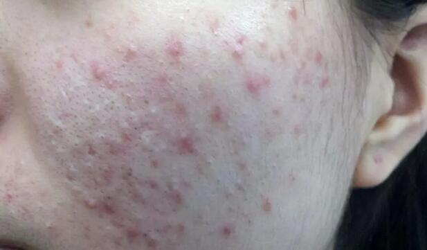 ͻȻ�����������ԭ����ʲô��������ɫ͹��һֱ������ô�죿